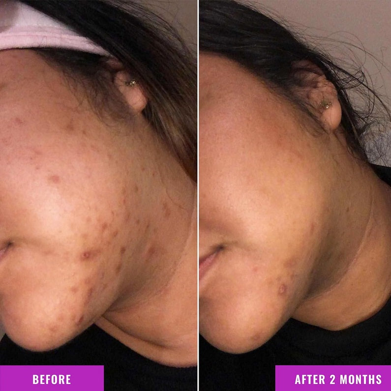 Good Molecules Discolouration Correcting Serum 30ml