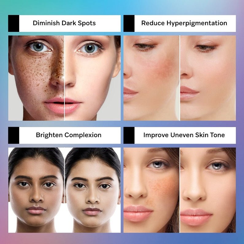Beautzilla Dark Spot Corrector - bodytonix