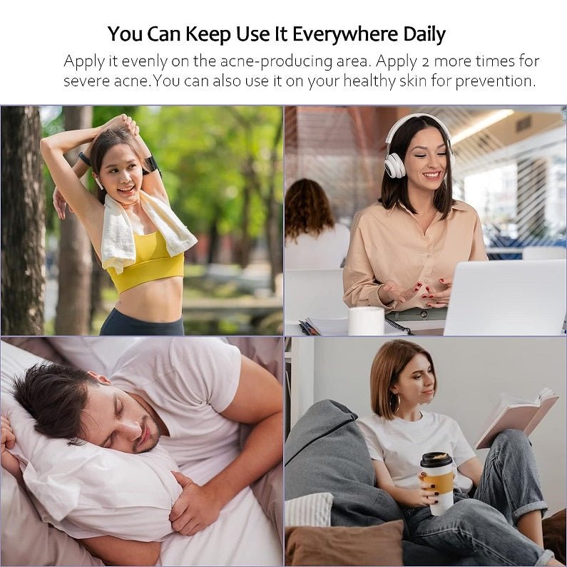 Tobcharm Butt & Back Acne Treatment Cream w/ Azelaic Acid - bodytonix