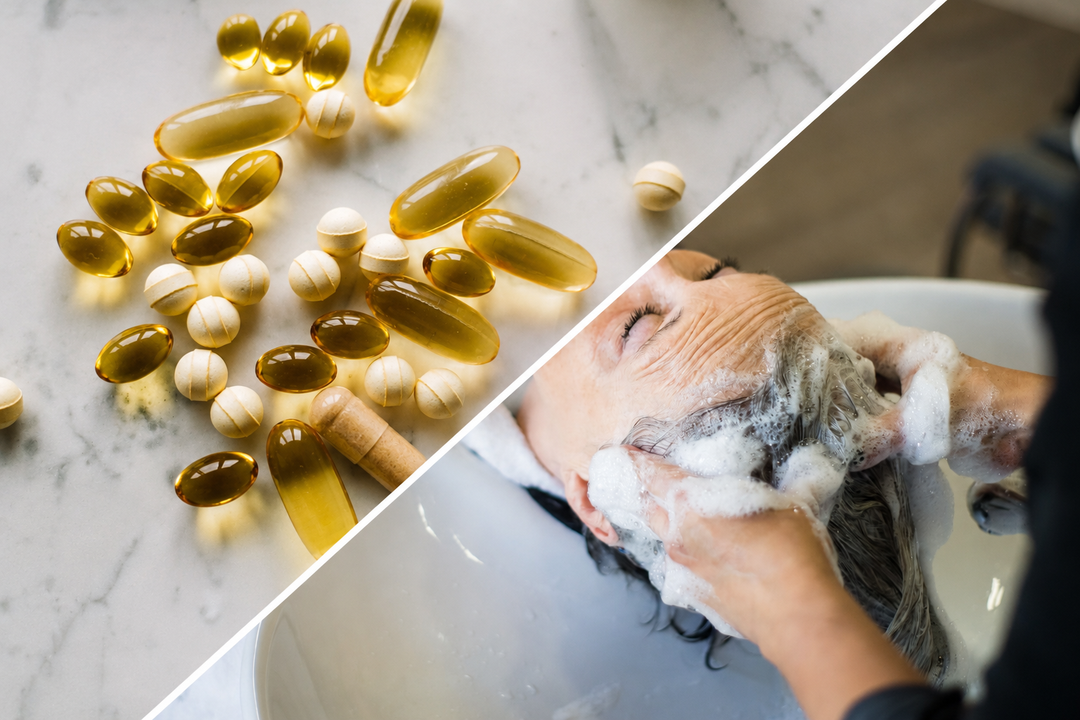 DHT Blocker Supplements vs Shampoos: Which Is Better?