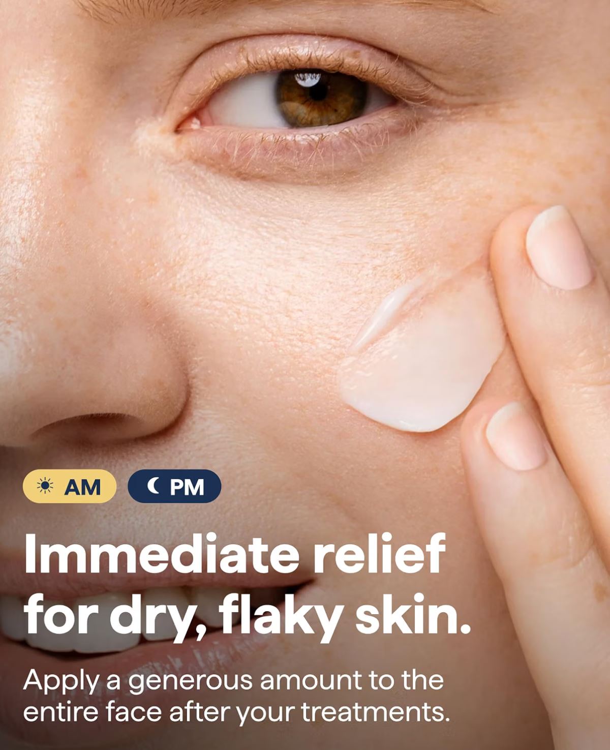 Remedy Rich Cream Moisturizer 50ml