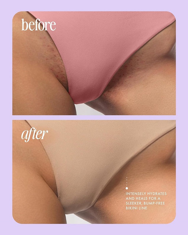 After shave oil before-and-after hydration graphic on bikini line