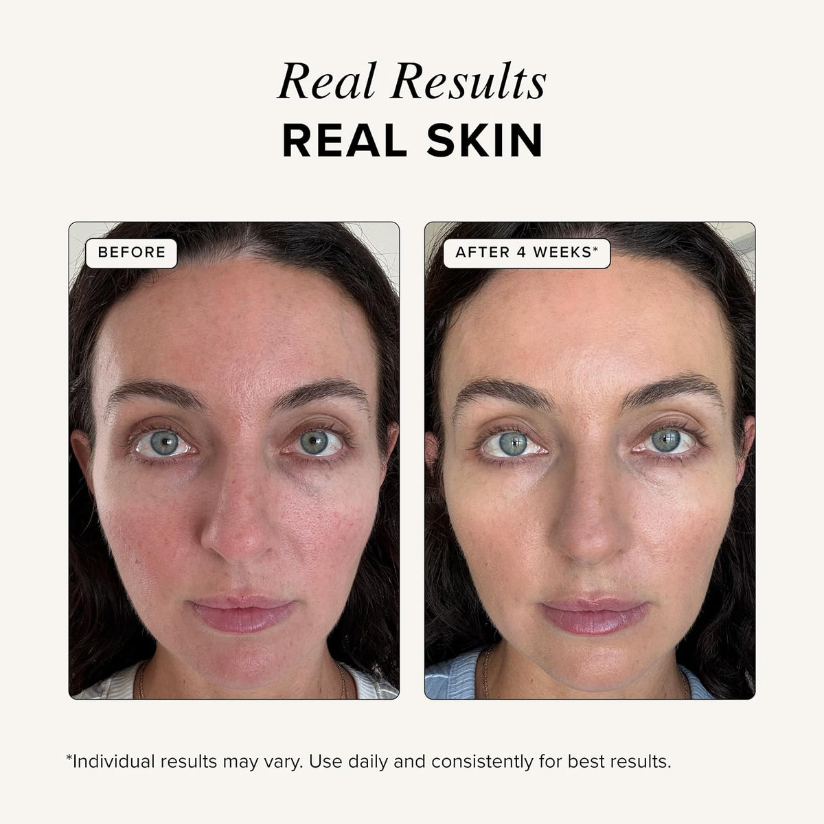 Before-and-after facial photo showing real-skin results after 4 weeks.