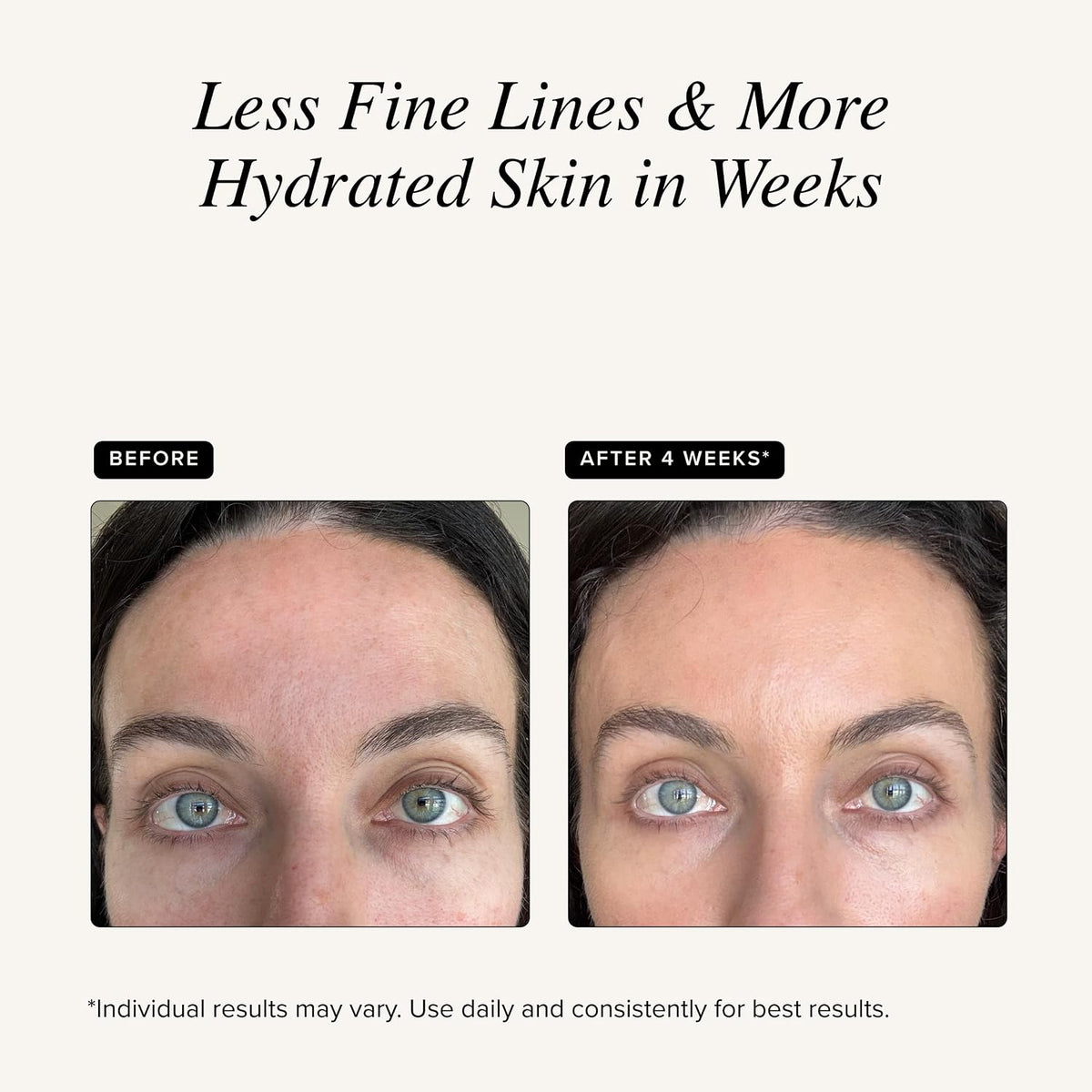 Before-and-after facial photo showing fewer fine lines after 4 weeks.