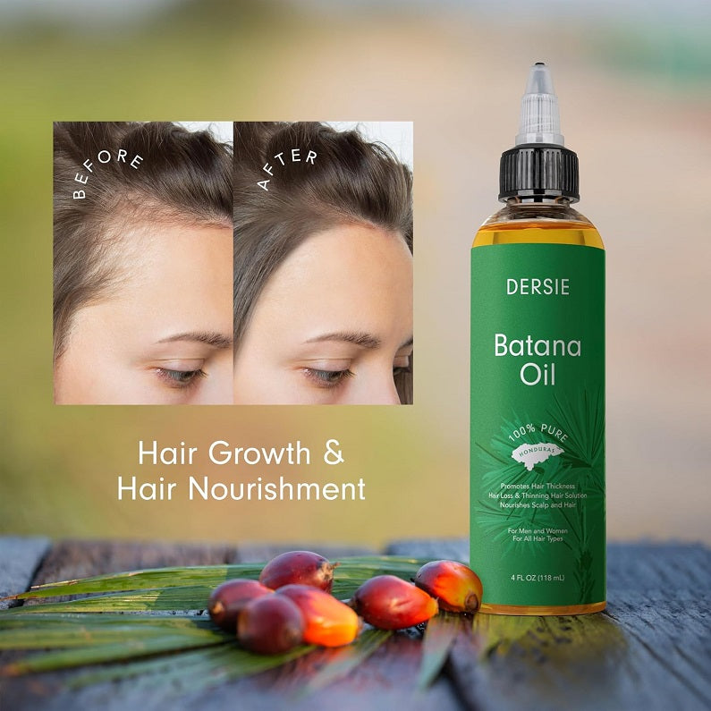 Batana oil bottle labeled for hair growth and nourishment, 118 ml