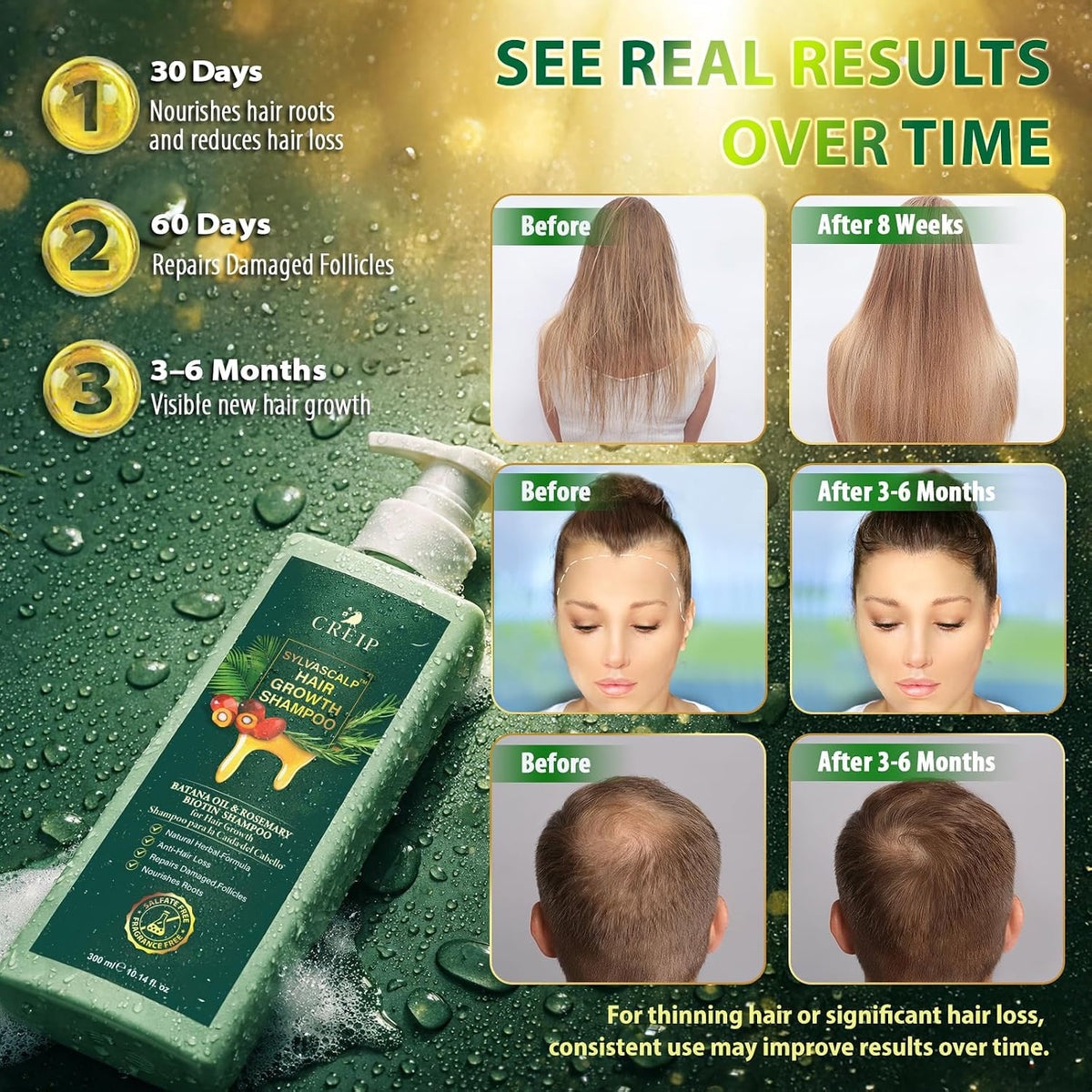Hair growth results infographic with shampoo package and before-and-after hair images