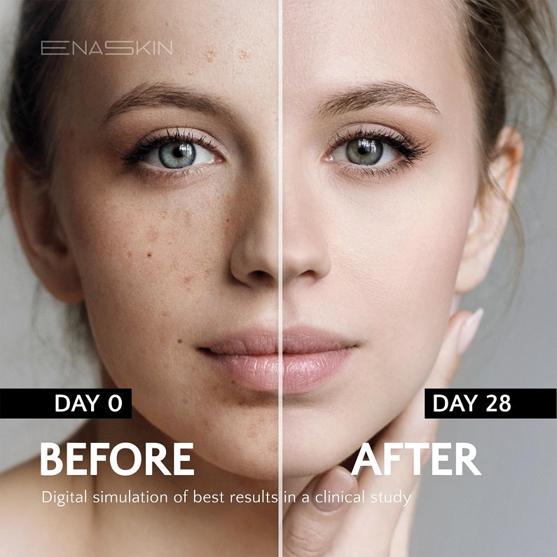 Split-screen of a woman's face showing day 0 and day 28 complexion results