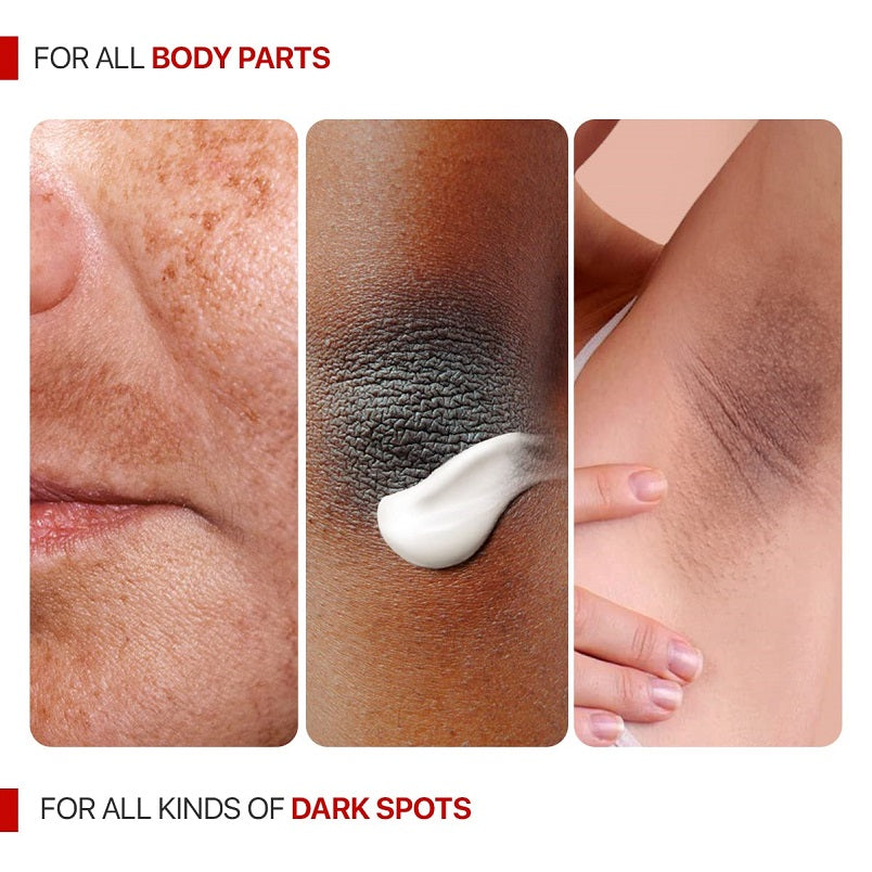 Dark spot corrector cream indicated for all body parts, shown on multiple skin areas