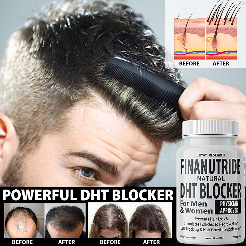 Natural DHT blocker bottle: IXYAY Research FINANUTRIDE physician approved for men & women
