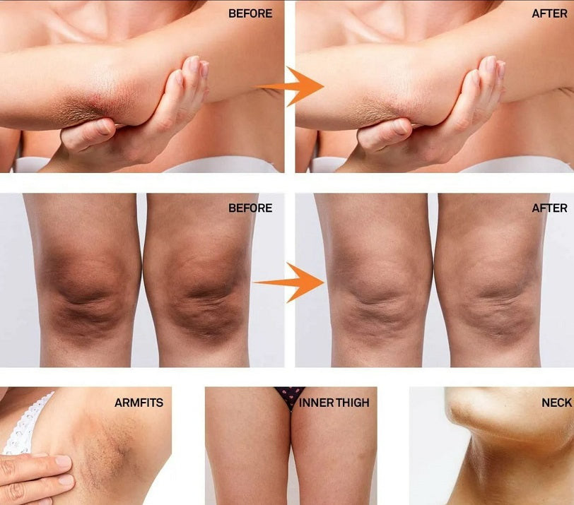Before-and-after skin lightening comparison on inner thighs with arrows and labels