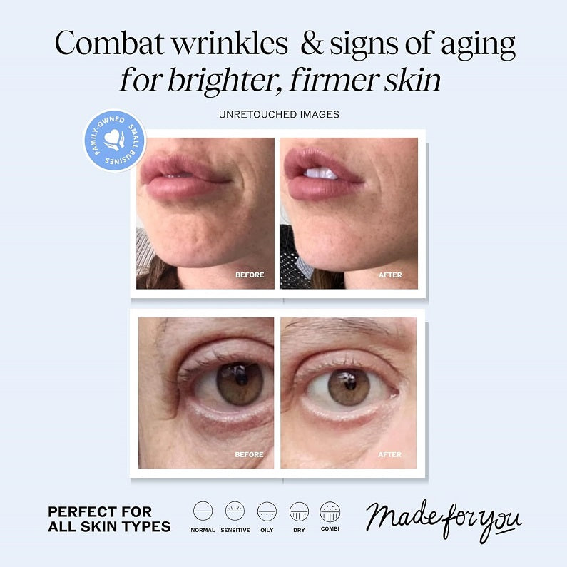 Retinol cream before-and-after skin results collage on face and eyes