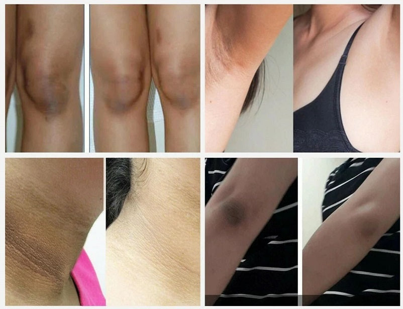 Skin whitening results collage showing smoothed, brighter skin on arms and legs
