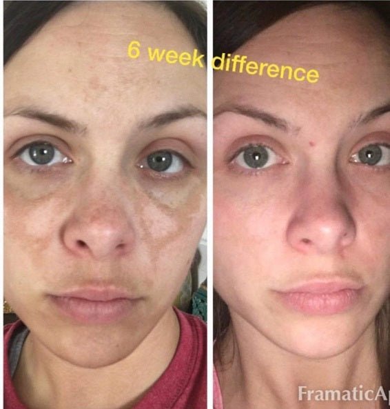 Face close-up with visible skin tone difference across cheeks and chin