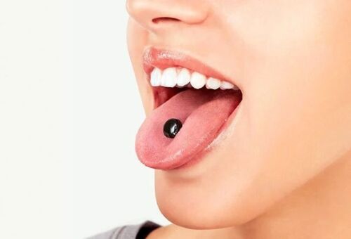 Mouth with a small black resin capsule on the tongue