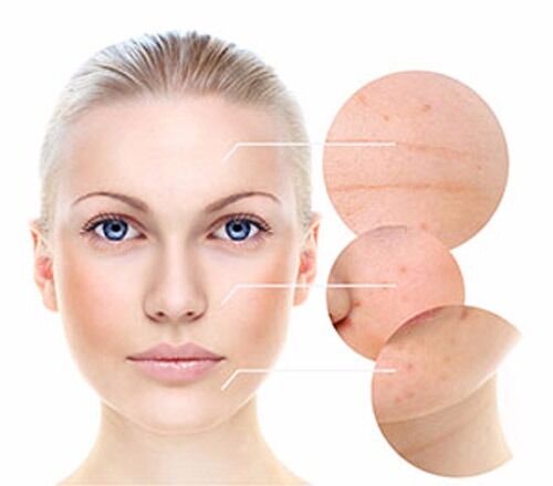Argireline hydration serum face-and-eye treatment diagram with circular target areas