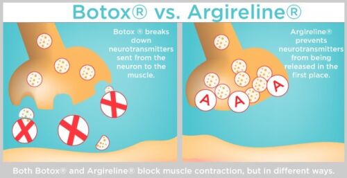 Botox vs Argireline comparison infographic with muscle contraction diagrams