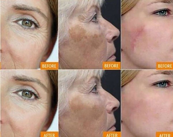 Collage of close-up faces showing skin before and after treatment