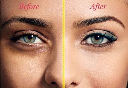 Before-and-after eye cream results with smooth under-eye appearance