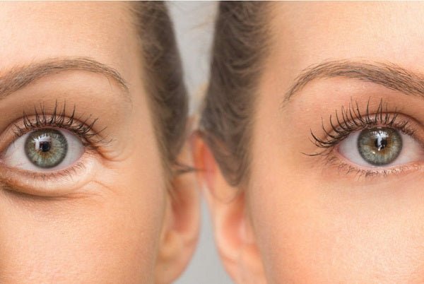 Close-up of model’s eyes with highlighted lashes and clear under-eye area