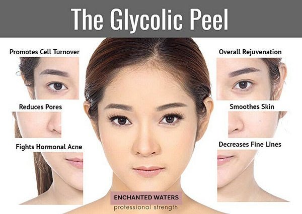 Glycolic peel promotional infographic with model portraits and skin benefit panels