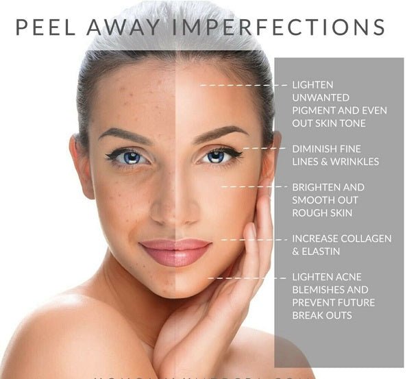 Model face with peel-away imperfection diagram arrows pointing to skincare areas