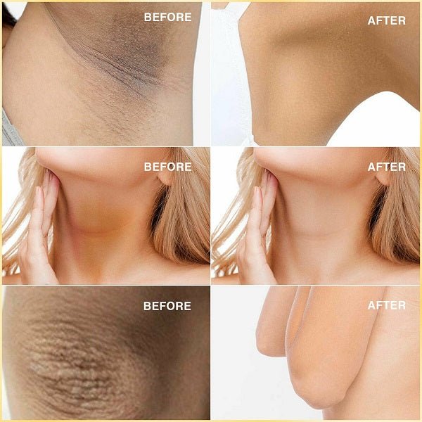 Collage of before-and-after skin brightening on face and hands
