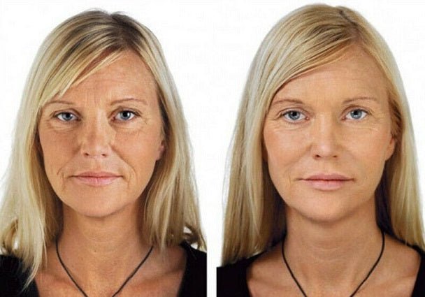 Before-and-after headshot portraits showing skin brightening