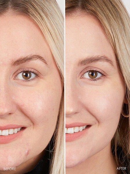 Side-by-side face close-ups showing skin before and after treatment