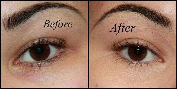 Face closeups labeled Before and After, skin looks smoother around the eyes