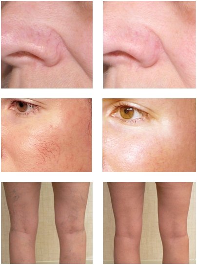Skincare result panels for face and legs, showing more even tone after treatment