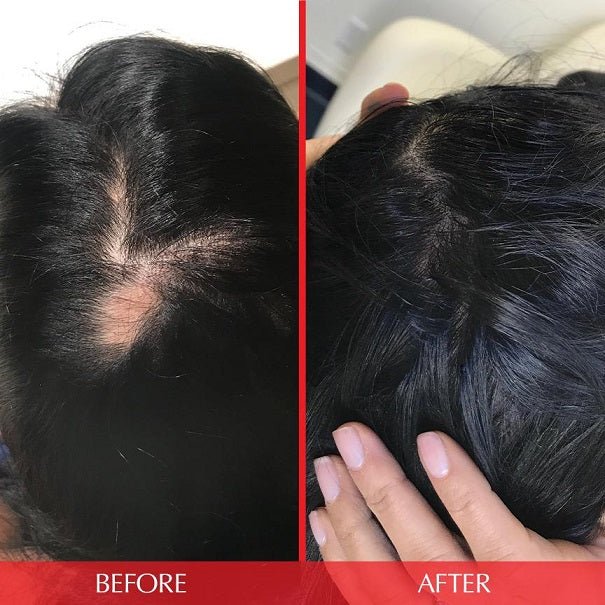 Hairtamin Advanced Formula Hair Growth Vitamins - bodytonix