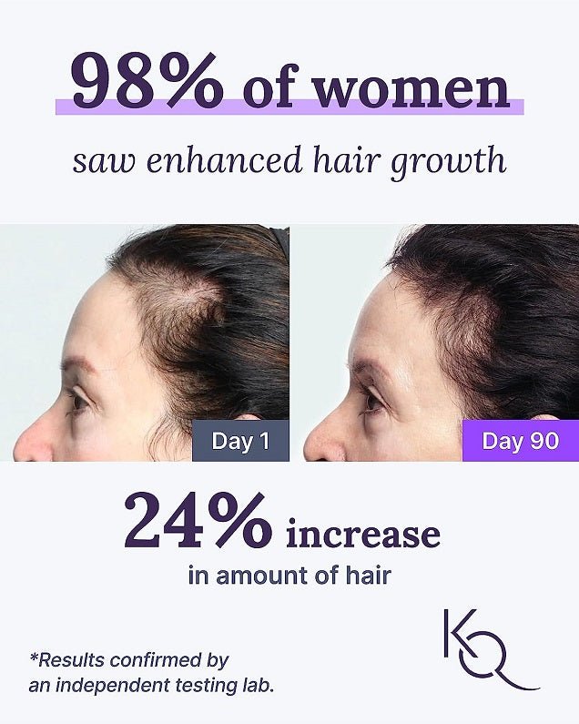 Hair growth results chart with Day 1 and Day 90 scalp photos and 24% increase claim