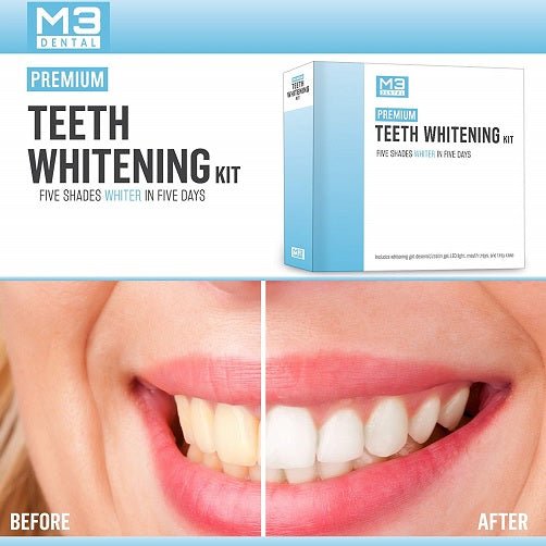 M3 Premium Teeth Whitening Kit - bodytonix