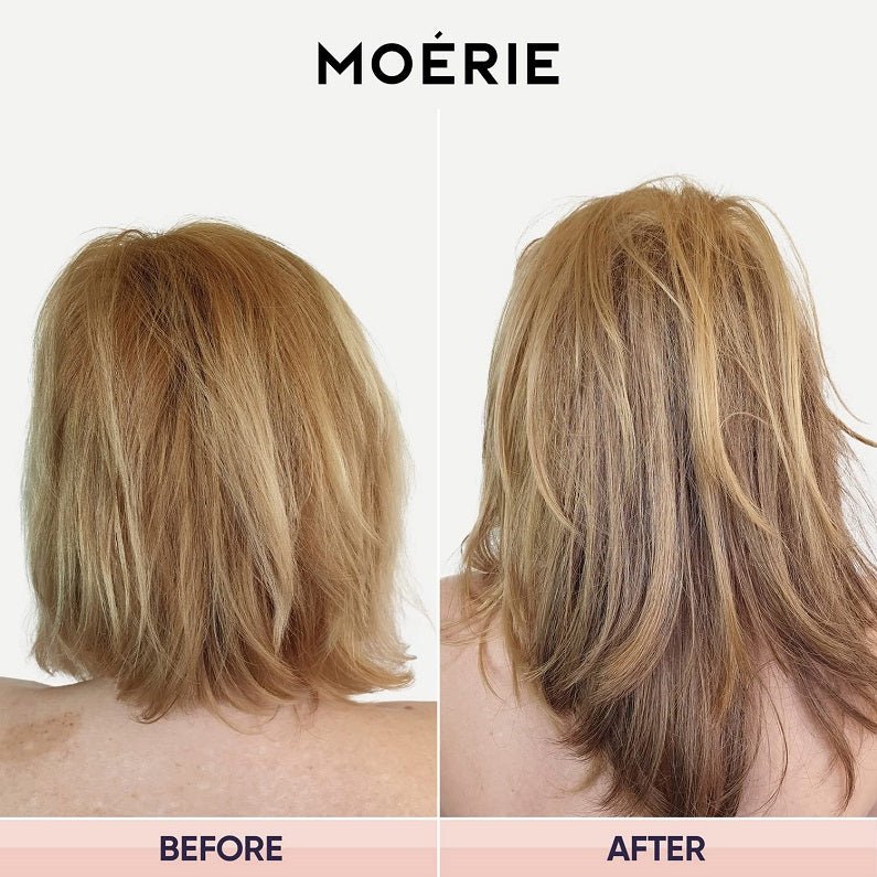 Moerie Ultimate Hair Growth Spray - bodytonix