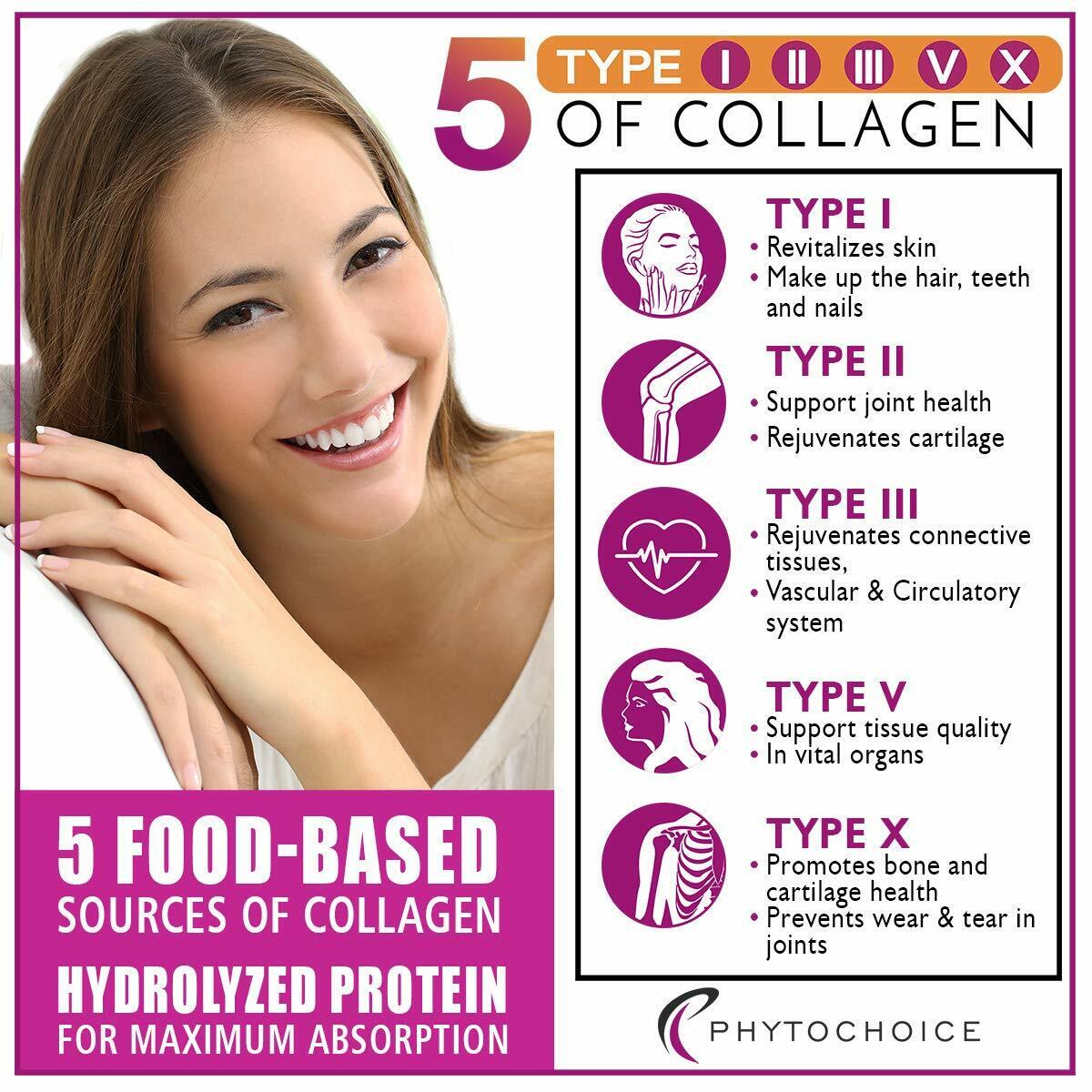 Phytochoice Collagen Multi Complex Types I, II, III, V & X - bodytonix