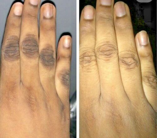Hands with dark knuckles in split view, showing whitening oil results