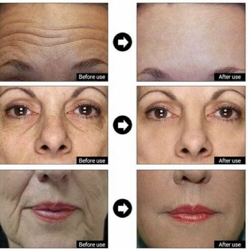 Skincare results collage showing face before use and after use for gel cream