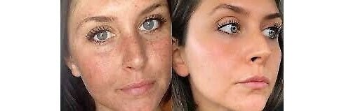 Close-up portraits of skin texture around eyes and cheeks