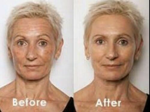 Split face view: before and after applying retinol gel-cream