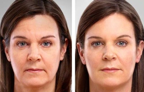 Retinol serum skincare results: split portrait of face, left and right panels