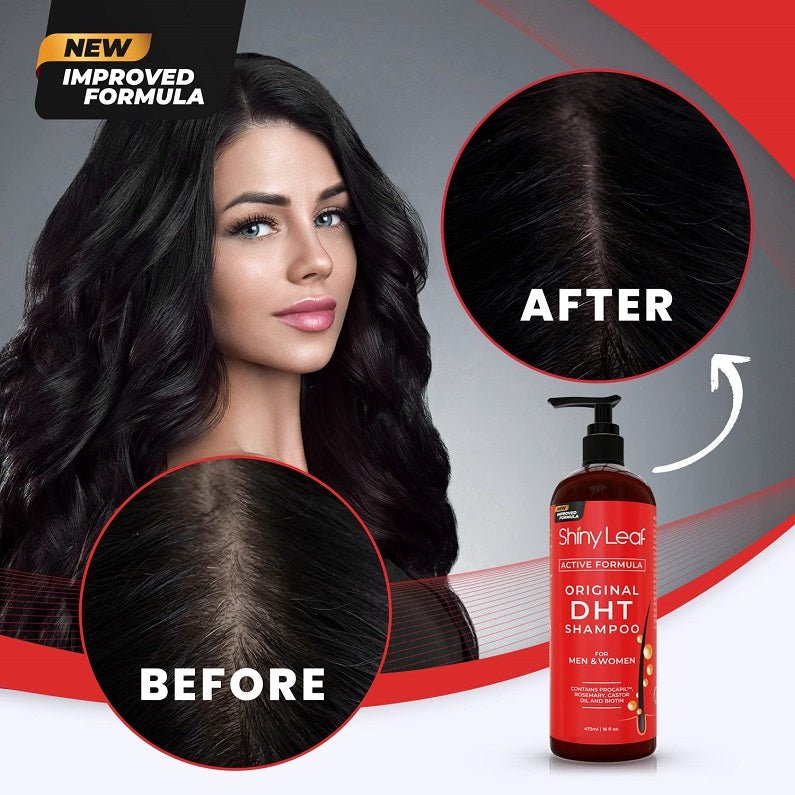ShinyLeaf Original DHT shampoo bottle with before-and-after hair promo graphic.
