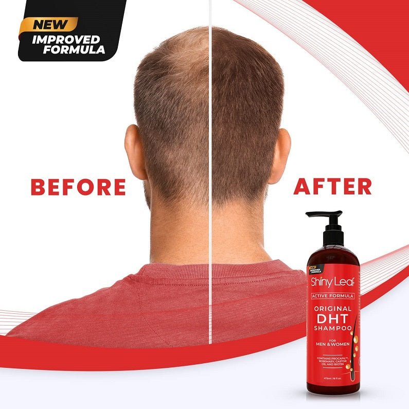 ShinyLeaf Original DHT shampoo bottle shown beside before-and-after hair split.