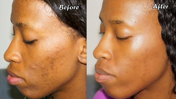 Before-and-after side profile showing smoother skin from turmeric honey sugar scrub