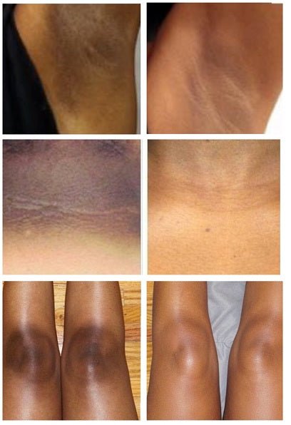 Skin tone comparison panels showing reduced dark spots on arms and legs