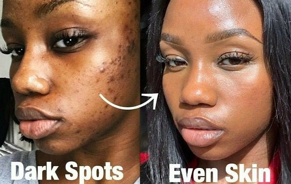 Skin whitening glow oil before-and-after on two women faces, split view