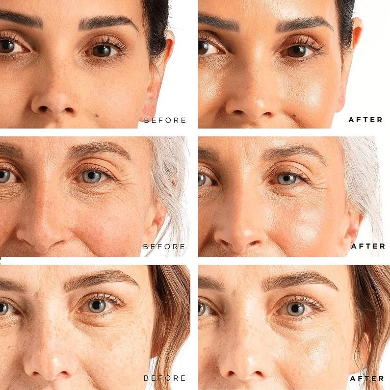 Split before-and-after closeup of face skin around eyes and forehead