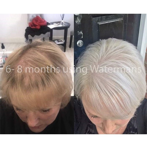 Watermans Hair Growth Shampoo + Conditioner - bodytonix